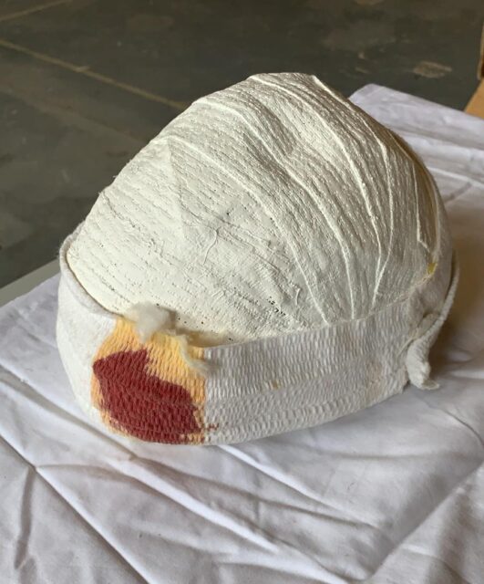 Mummyhoed met hoofdwond - 